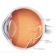 Retina Detachment